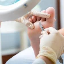 Callus Removal